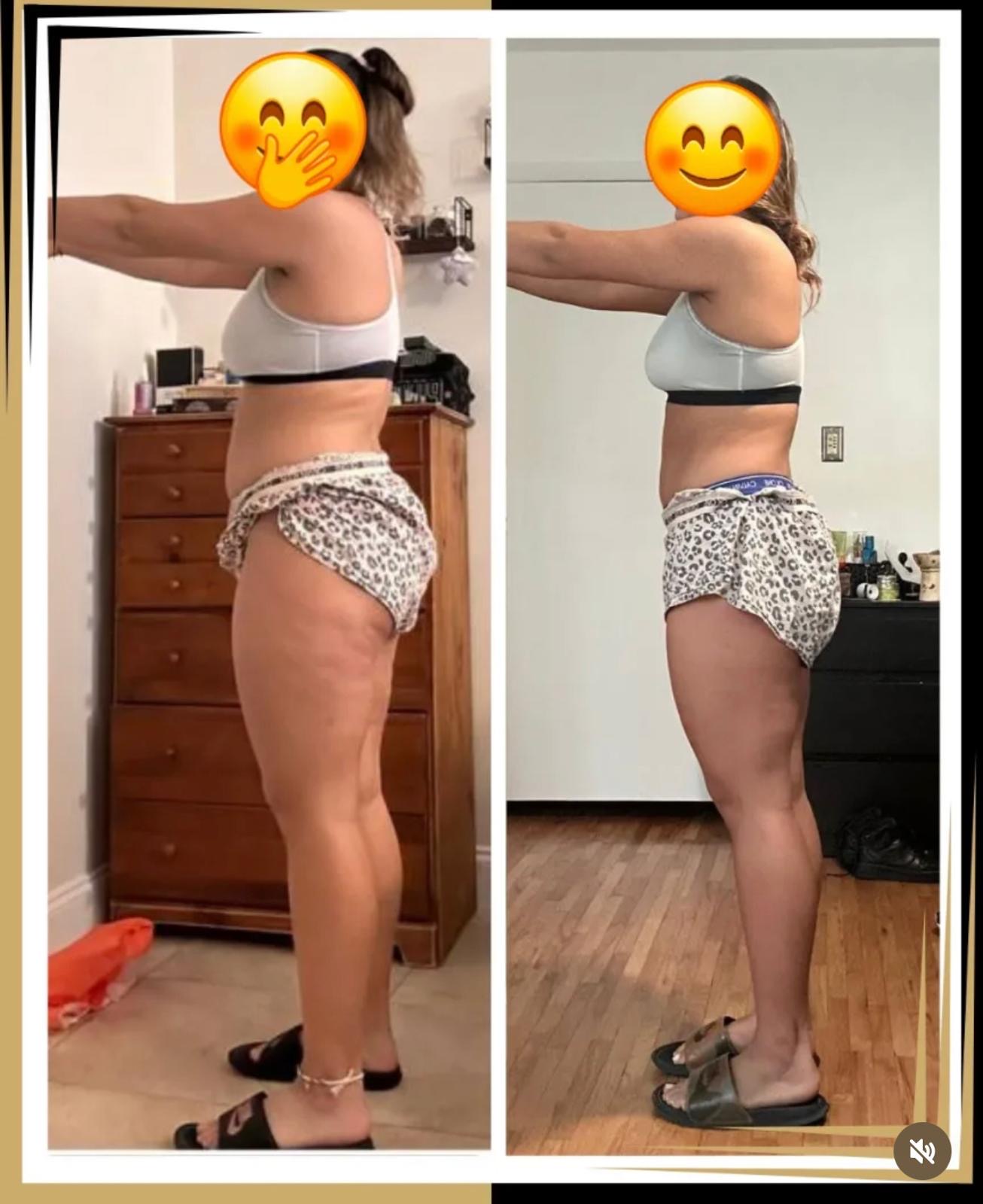 Client 1 transformation, side profile — before on the left, after on the right