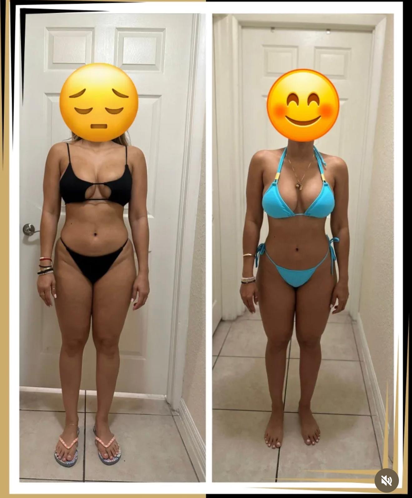 Client 2 transformation, front view — before on the left, after on the right