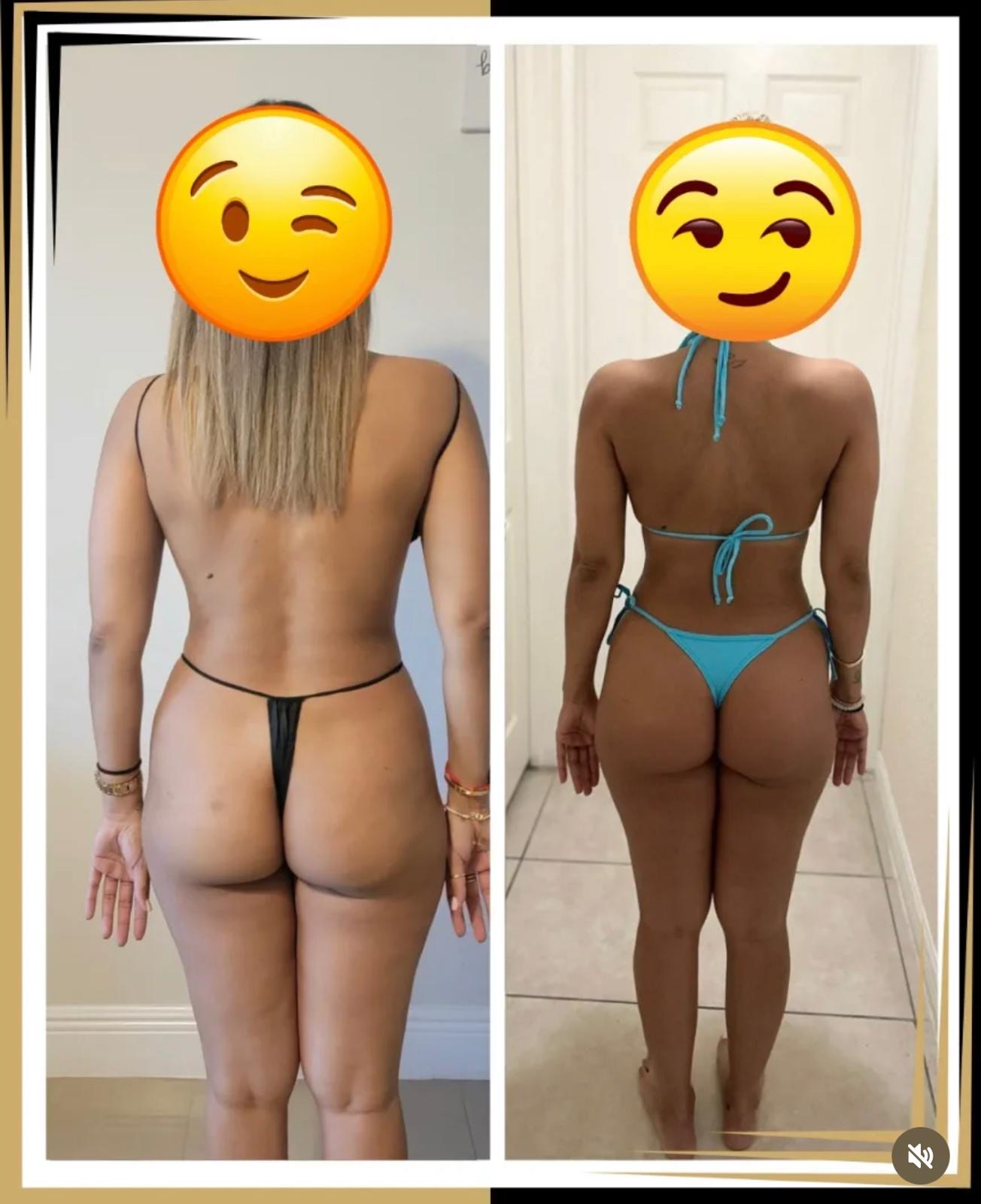 Client 2 transformation, back view — before on the left, after on the right