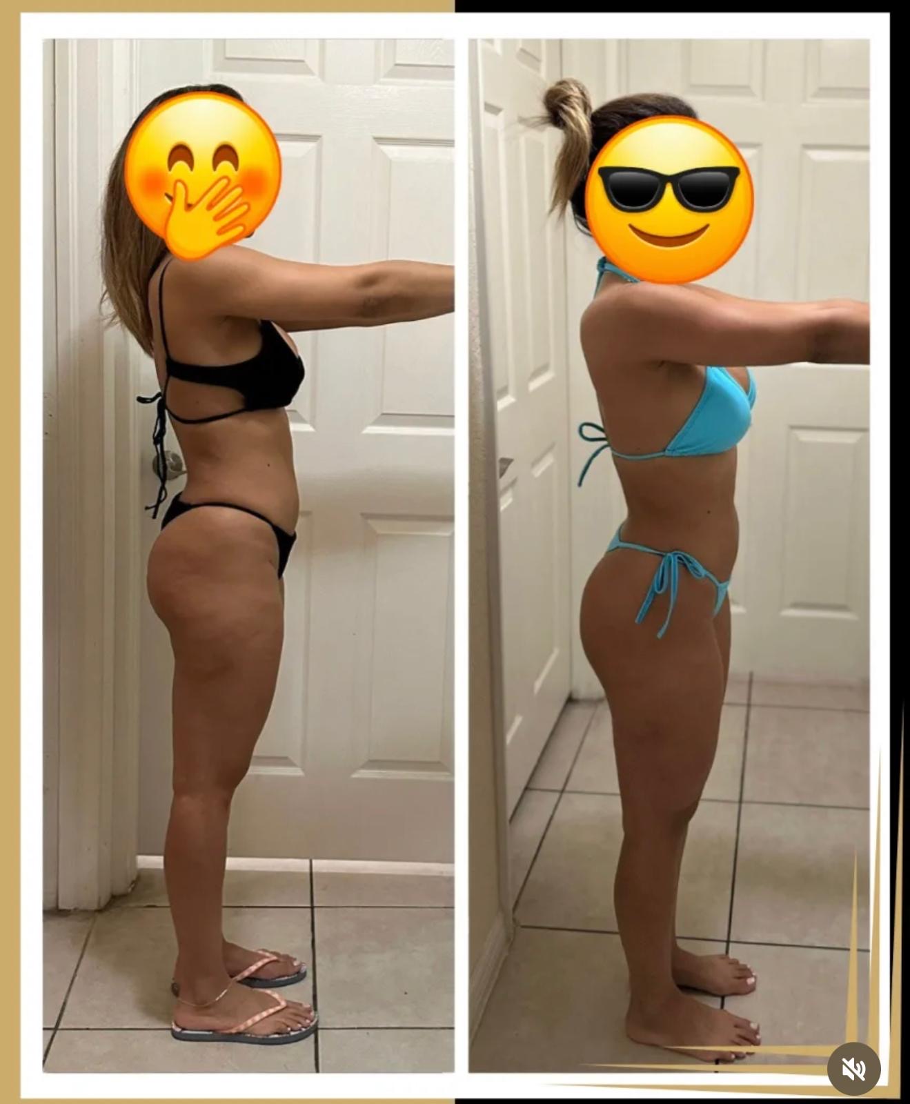 Client 2 transformation, side profile — before on the left, after on the right